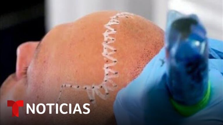 Tratamientos Innovadores para Problemas Capilares