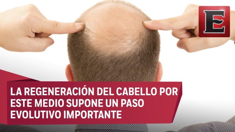 Tratamientos Regenerativos Efectivos contra la Ca&iacute;da del Cabello