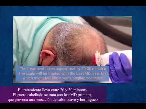 Innovaci&oacute;n en Tratamientos Capilares con L&aacute;ser